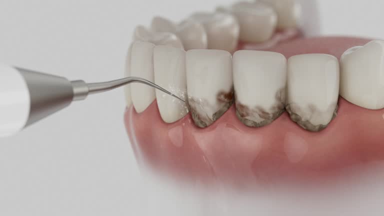 Trusted Tooth Extraction service in North Liberty, IN - Dentist Open Now